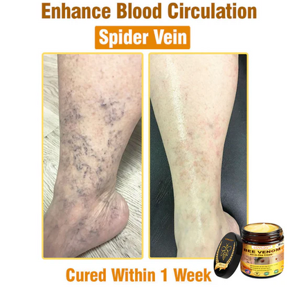 South Moon Bee Venom Pain Relief Cream for Arthritis, Muscle & Joint Discomfort (Original)