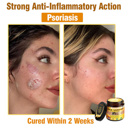 South Moon Bee Venom Pain Relief Cream for Arthritis, Muscle & Joint Discomfort (Original)