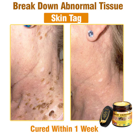South Moon Bee Venom Pain Relief Cream for Arthritis, Muscle & Joint Discomfort (Original)